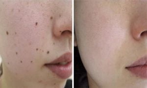 70776443 2499958840238511 8869392810982244352 N 1