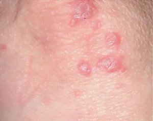 Lối sống tích cực là liều thuốc quý giá nhất để duy trì huyết áp ở ngưỡng an toàn 