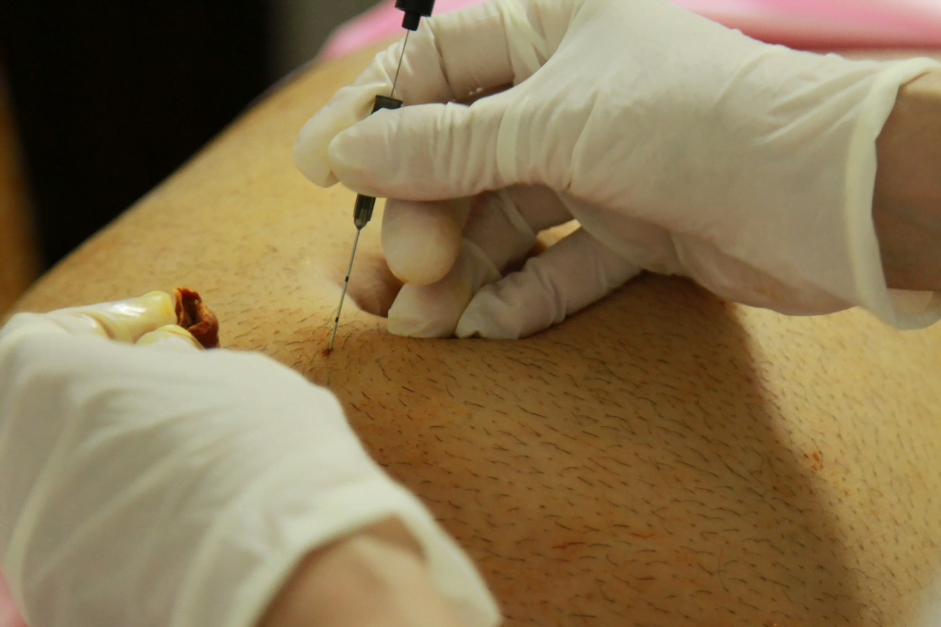 Tien Si Alock Cay Chi Trai Trung Tam Dong Phuong Y Phap 2 1