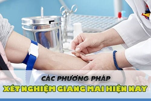 5C74Ef257Afdf99718A2B5D4 5C1C92Ef0Fcb8380Ce44Ecc1 Phuong Phap Xet Nghiem Giang Mai 1