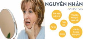 Nguyen Nhan Lao Hoa Da 1 1