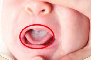 20200618 070534 312668 169647 Tre Bi Tua L.max 1800X1800 1