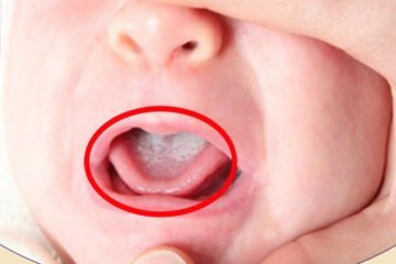 20200618 070534 312668 169647 Tre Bi Tua L.max 1800X1800 1