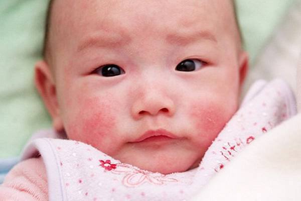 Tre Bi Viem Da Co Dia