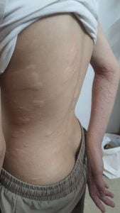 W