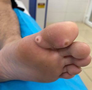 C5Da32962Abdd5E38Cac